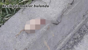 Kesik parmakların kime ait olduğu ortaya çıktı